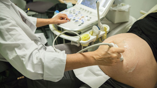 Lépett a kormány, végre nem kell külföldre menni a megoldásért