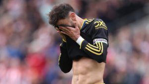 Büntetője volt egyenlítéshez, így sem tudta elkerülni a csúnya égést a Manchester United