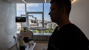 Ez nem sci-fi, megérkezett a jövő fogorvoslása: 3D mosolytervezés és stresszmentes fúrás