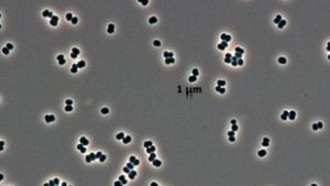 Halottnak tetteti magát a NASA baktériuma, a sterilizáció sem öli meg