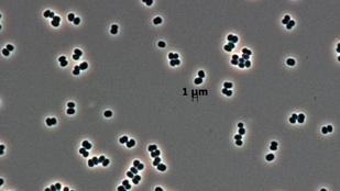 Halottnak tetteti magát a NASA baktériuma, a sterilizáció sem öli meg