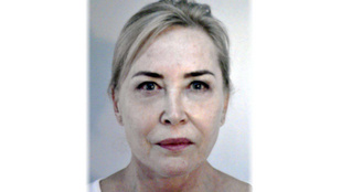 Gerincműtétje után eltűnt Szegeden a szekszárdi kórház egyik főorvosa