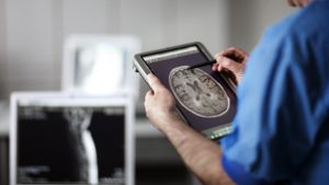 Áttörés jön az Alzheimer-kór kutatásában, egy népszerű fogyókúrás szer segíthet